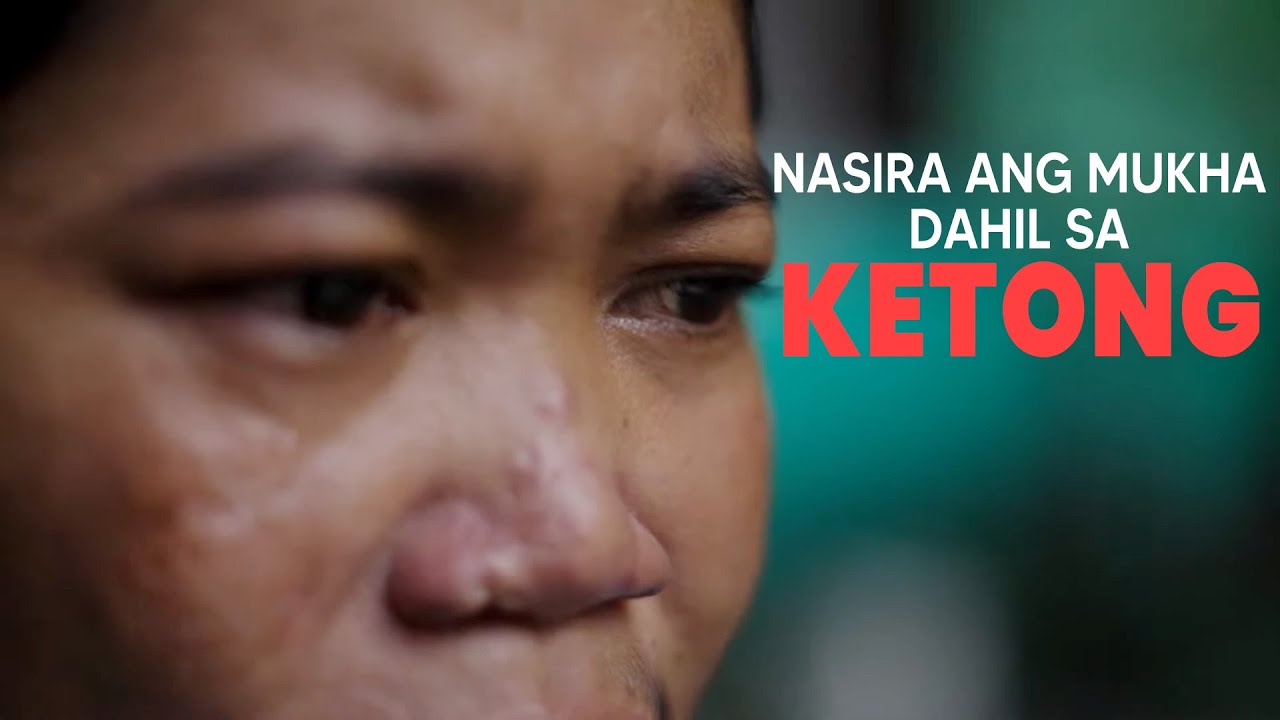 KETONG: DAPAT BANG KATAKUTAN? | Doctor Dex Documentary (Full Episode)