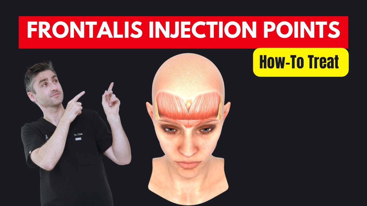 How-To Treat The Frontalis With Botox | Dr Chris Hutton Aesthetics Training