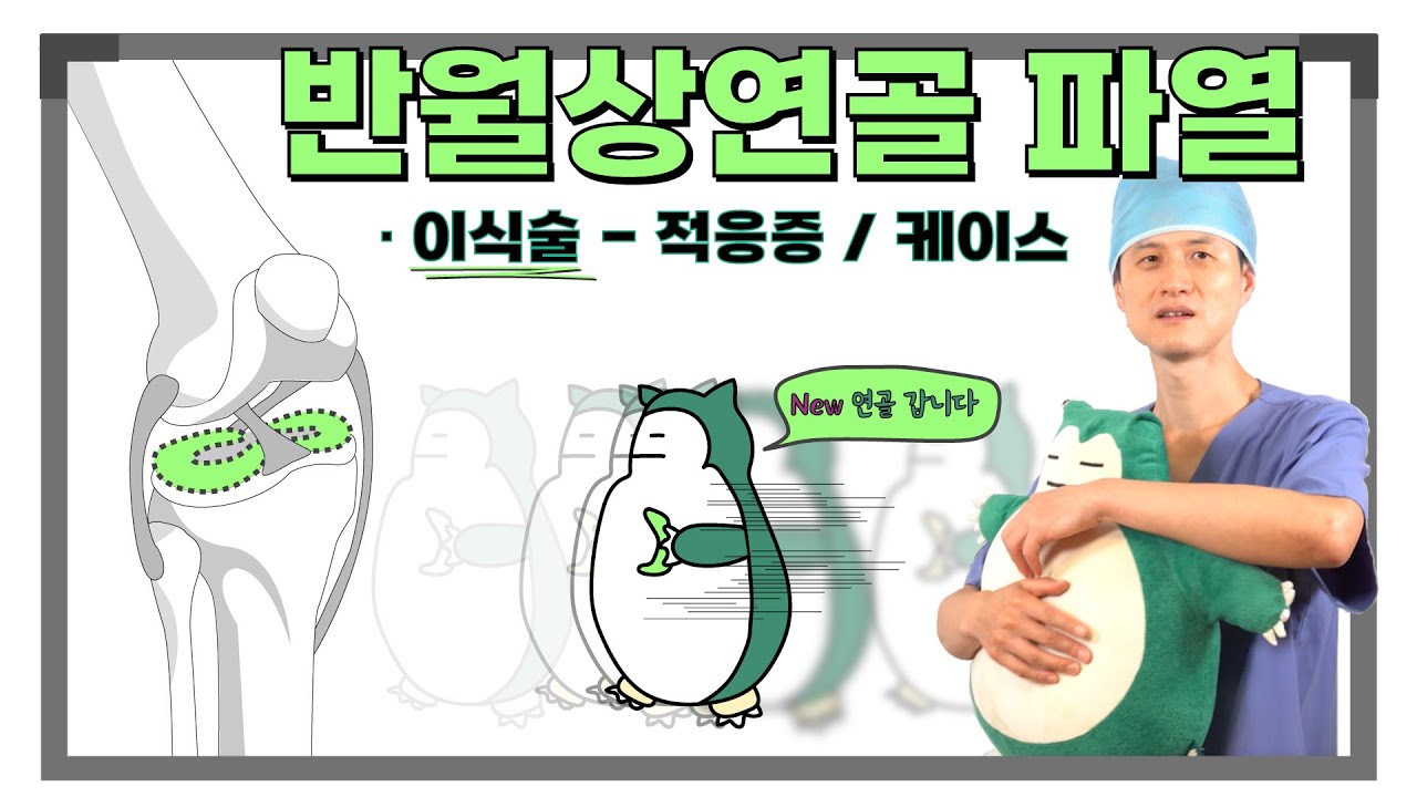 반월상연골파열 3 시리즈 2, 3 - 이식술 적응증, 케이스