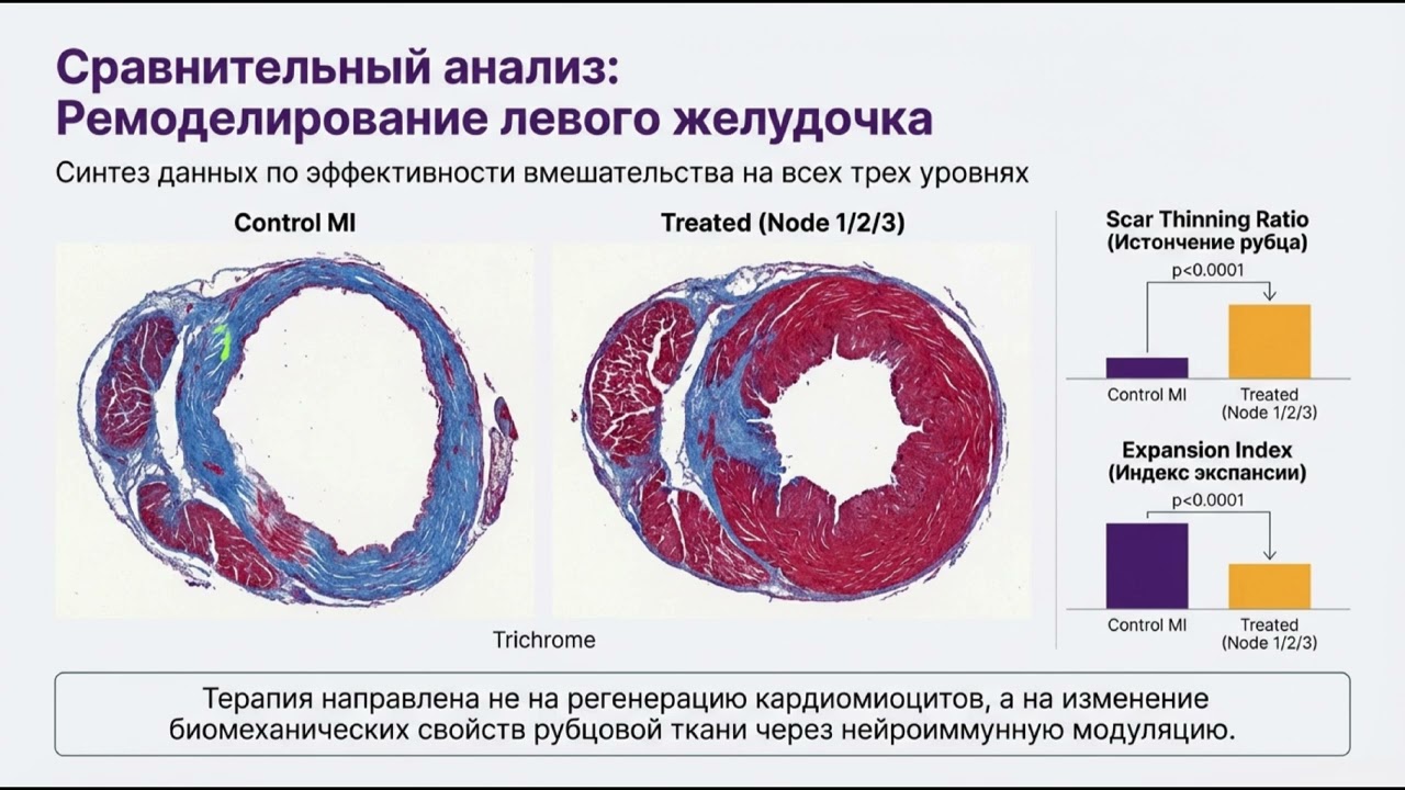 Как мозг добивает сердце после инфаркта