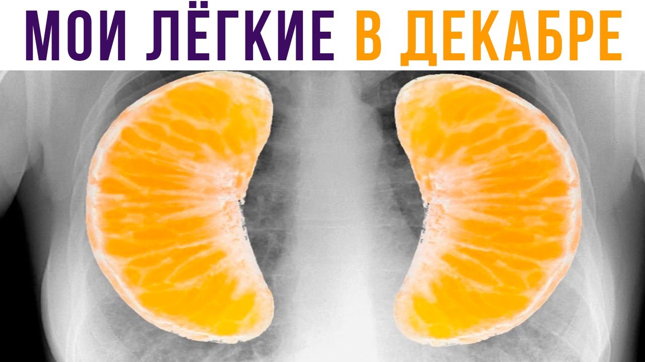 МОИ ЛЁГКИЕ В ДЕКАБРЕ))) Приколы | Мемозг 