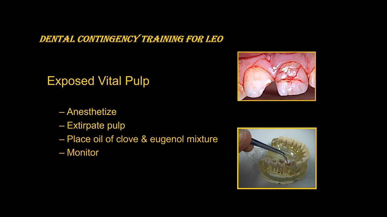 Dental Considerations for Spaceflight Planning: Spaceflight Dental Awareness | Dr. Michael Hodapp