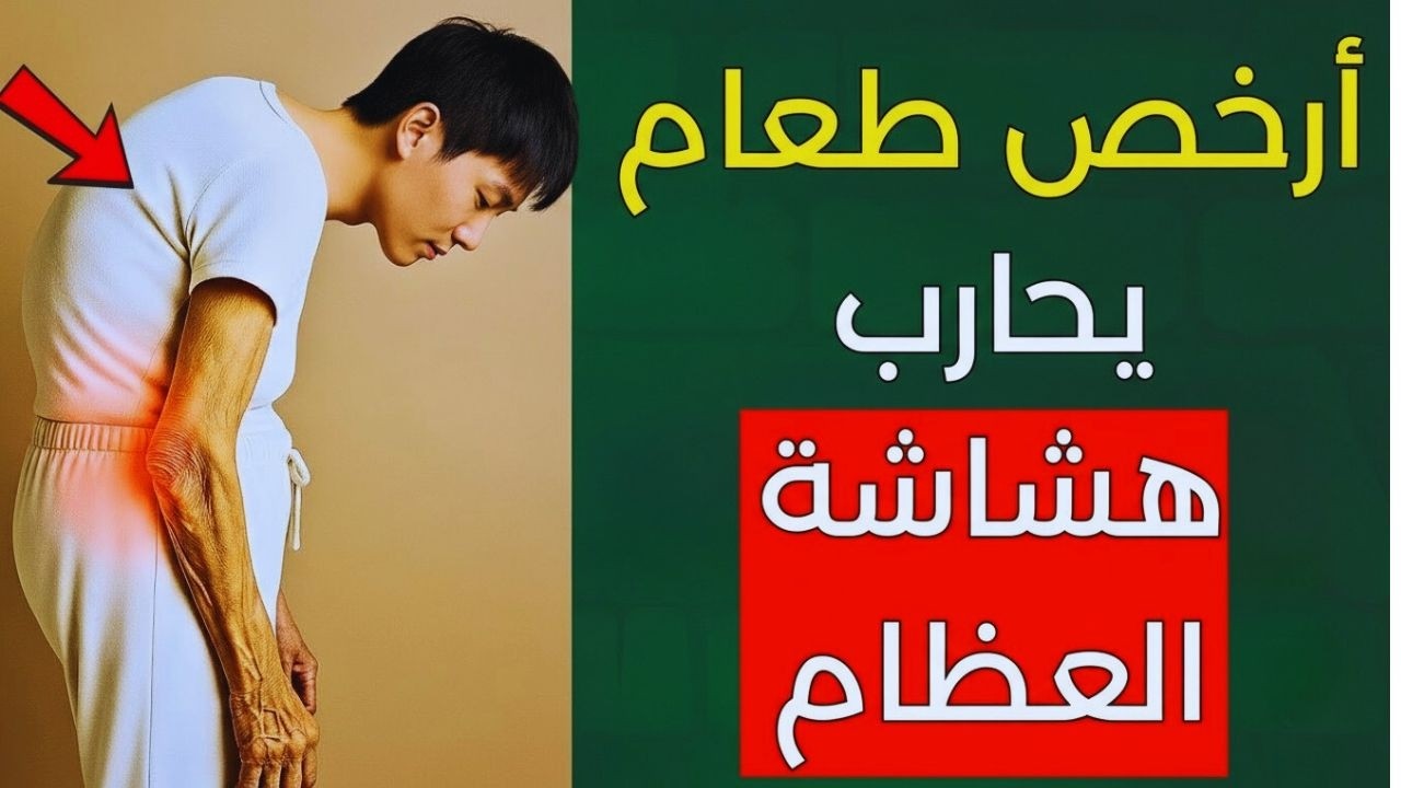 شاشة العظام بعد سن الستين: أرخص غذاء يومي يدعم كثافة العظام ويقلل خطر الكسور!