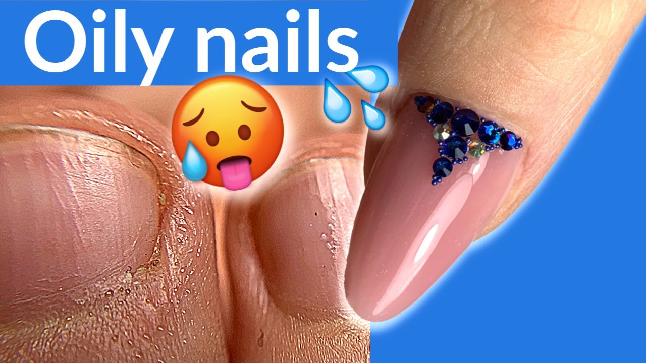 Extensions on Oily Nails | Hyperhidrosis