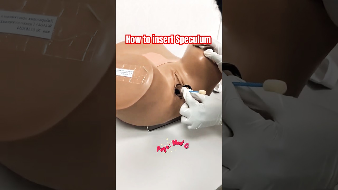 A simulation of swab collection with a vaginal speculum on a mannequin.
