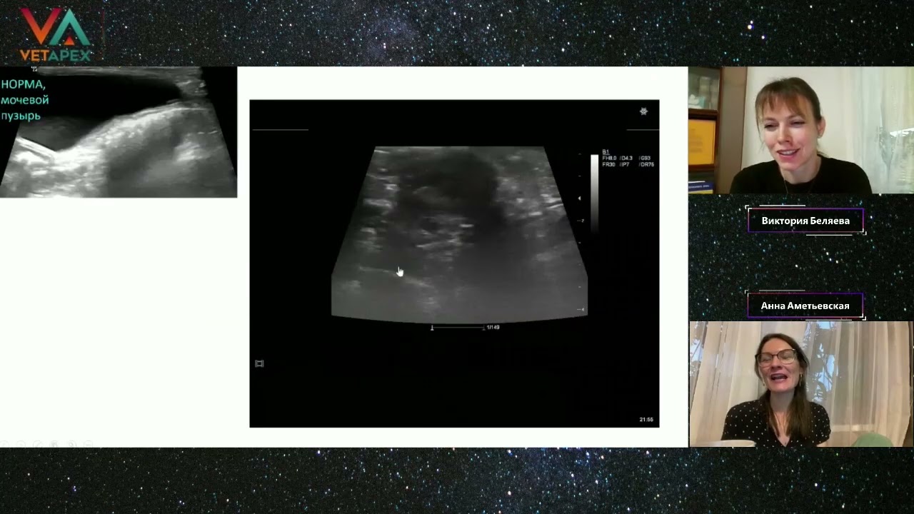 ОРБИТА с Викторией Беляевой и Анной Аметьевской. Диалог с анестезиологом