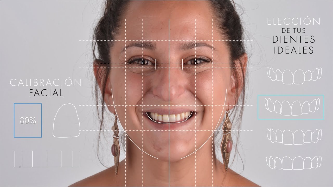 Pepa Rus : Estética Dental