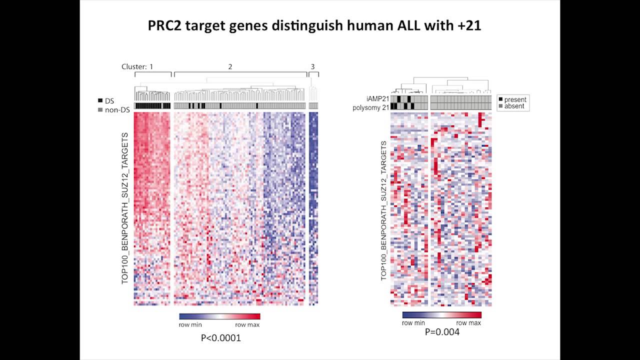 Histone H3K27 Demethylases as a Therapeutic Target in Polysomy 21 Leukemia