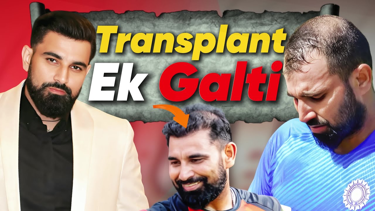 Mohammed Shami’s Hair Transplant Disaster – What Went Wrong? | Hair Transplant Journey