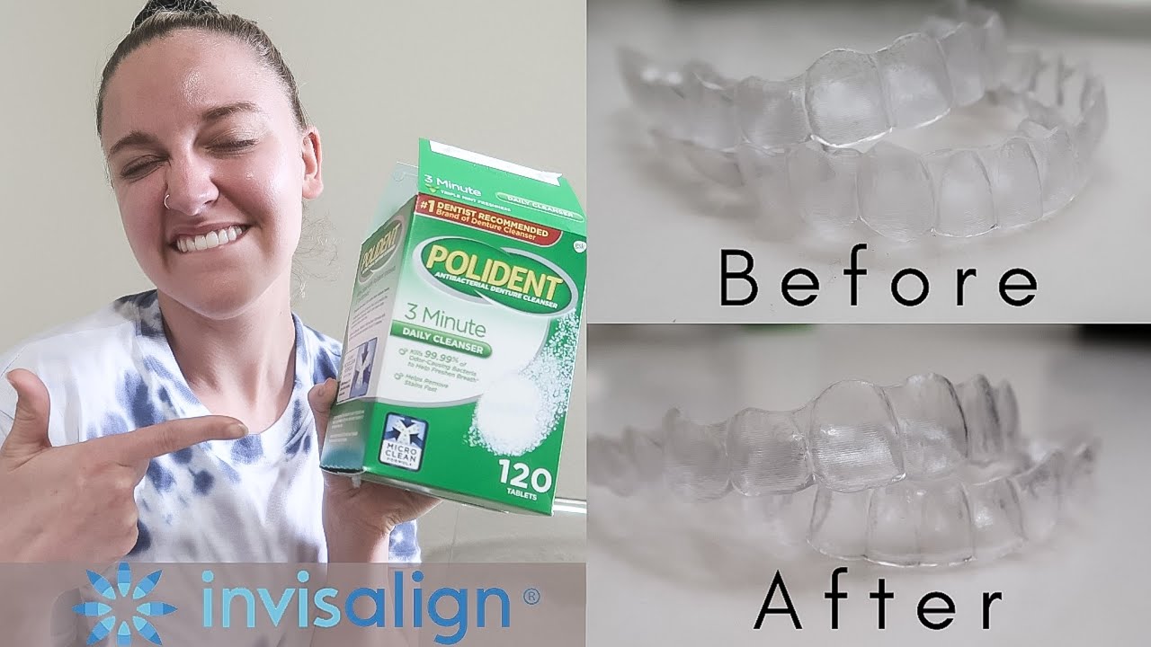 INVISALIGN UPDATE: Tips and Tricks for Clean Trays, No Stains or Smelly Trays!! + DEMO!