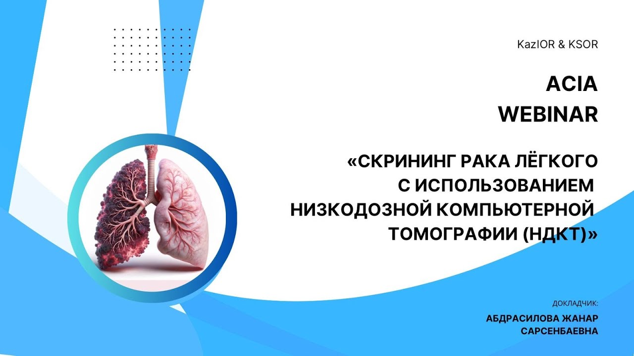 «Скрининг рака лёгкого с использованием низкодозной компьютерной томографии (НДКТ)»