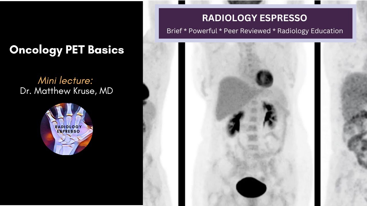 ONCOLOGY IMAGING and PET BASICS: Mini Lecture, Dr. Matthew Kruse