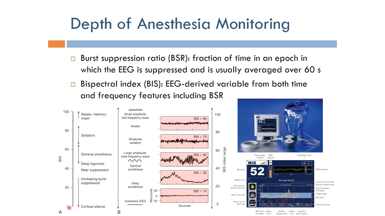 Anesthesia: Depth of Anesthesia Monitoring (English Narration)