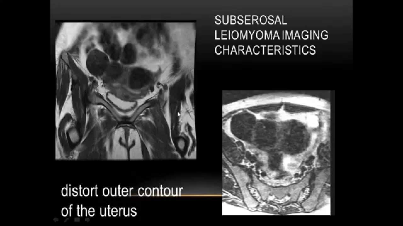 2015 AOCR Radiology Case Review: Women's Imaging