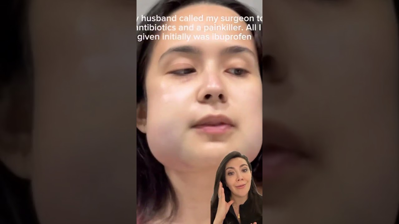 What Can Happen After You Remove Impacted Wisdom Teeth!?