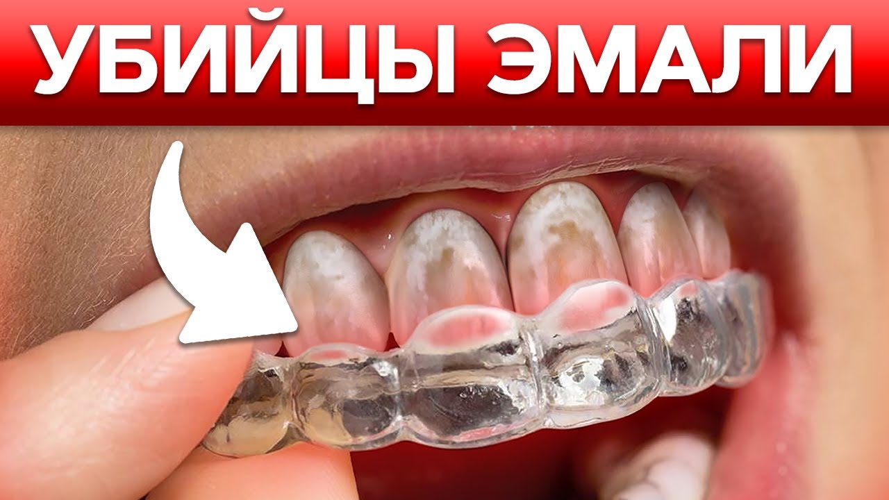 Капы портят ЗУБНУЮ ЭМАЛЬ?! Что будет, если носить ОРТОДОНТИЧЕСКИЕ КАПЫ?