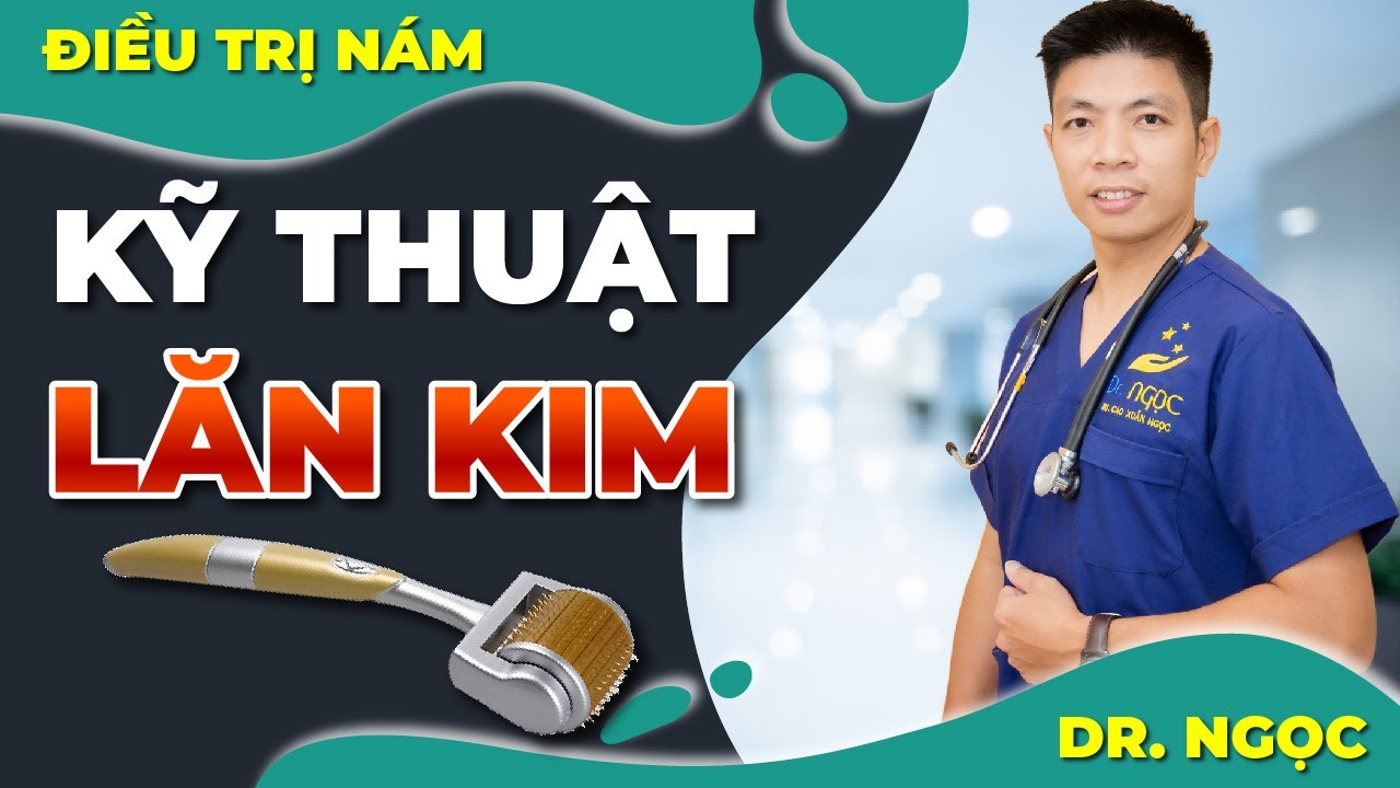 Kỹ thuật lăn kim ĐIỀU TRỊ NÁM /DR.NGỌC