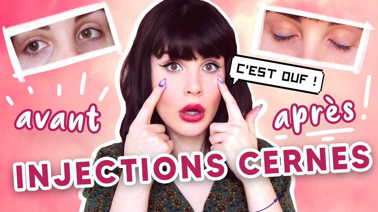 Mon expériences avec les injections dans les cernes.