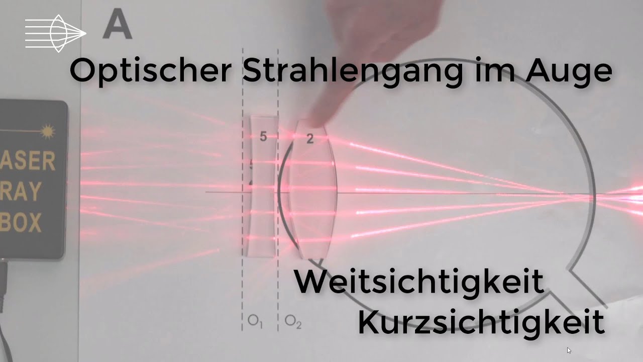 Optischer Strahlengang im Auge, Weitsichtigkeit, Kurzsichtigkeit, Physik Optik Experiment