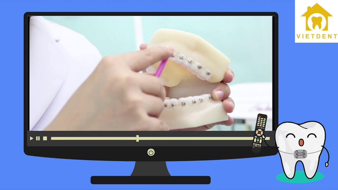 Clip hướng dẫn chải răng khi đeo niềng_Nha khoa Vietdent