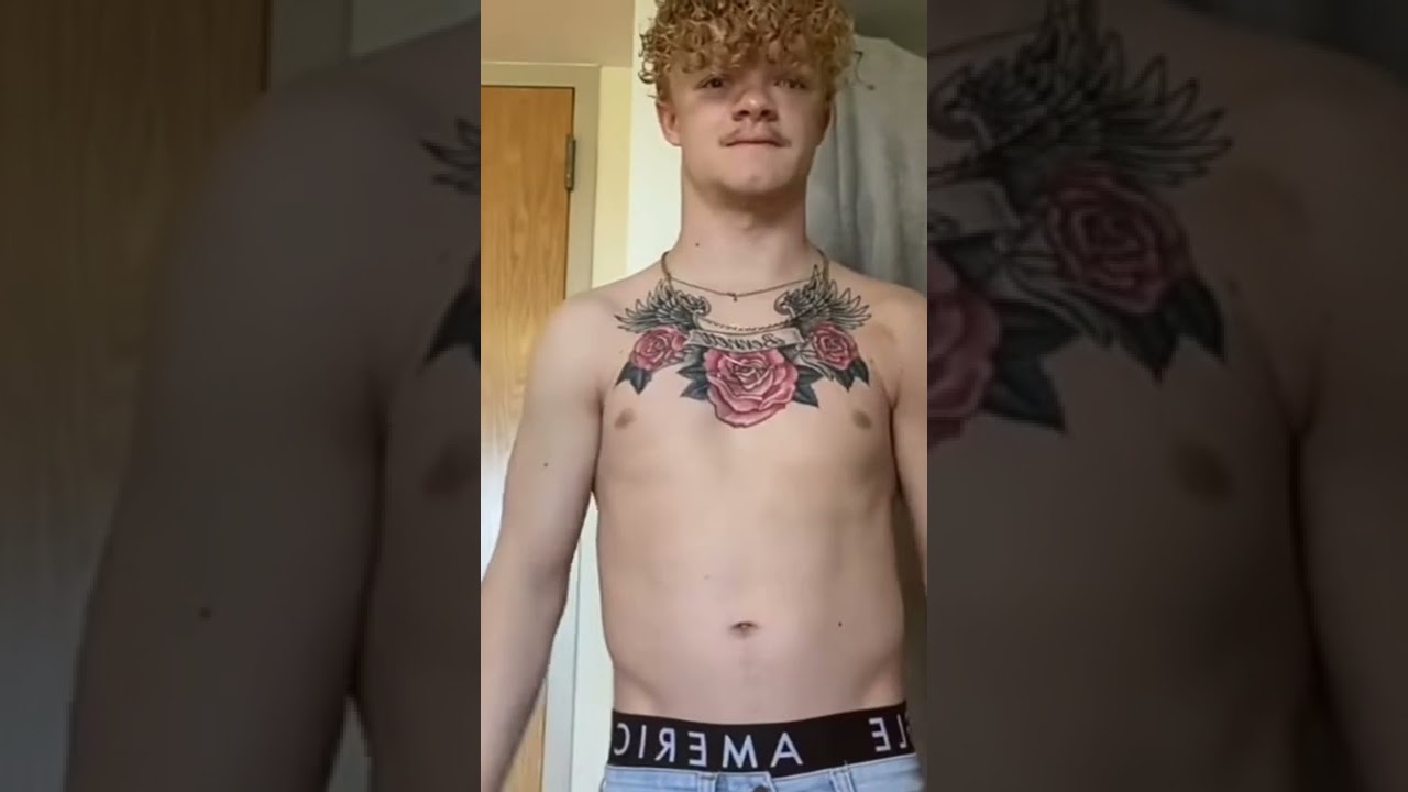 Man Born Without A Collarbone
