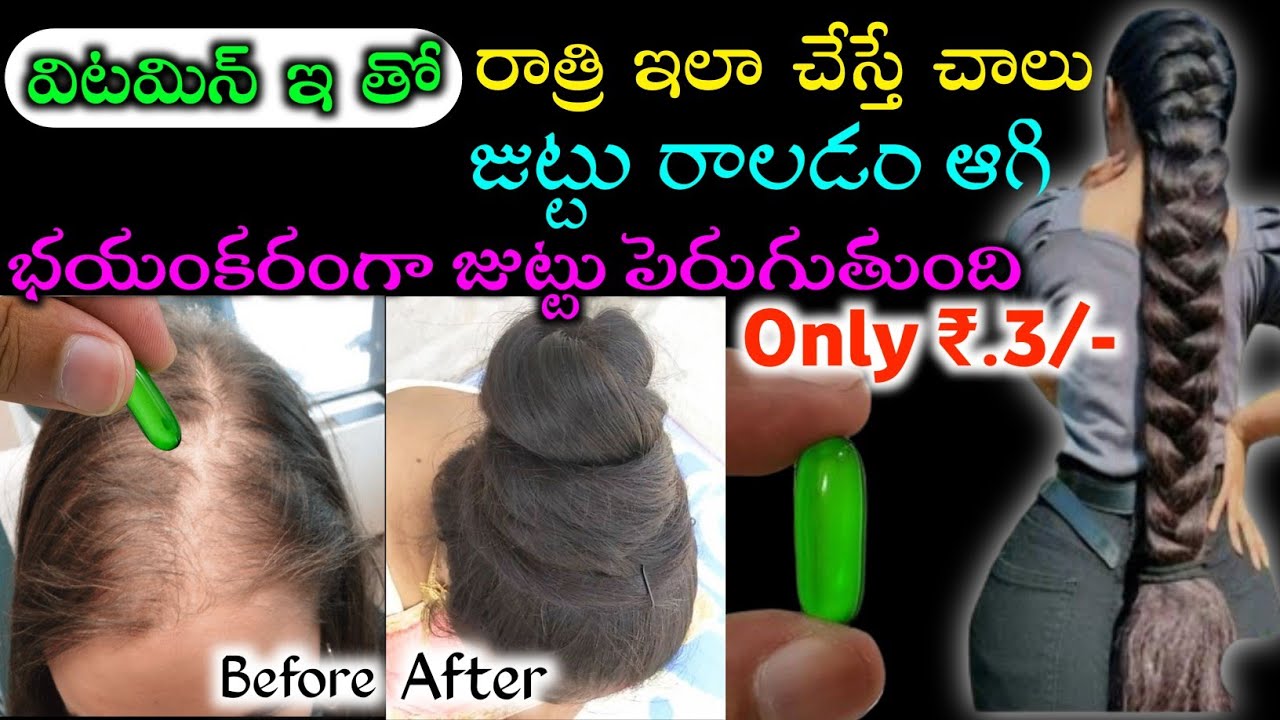 విటమిన్ ఇ తో జుట్టు విపరీతంగా పెరుగుతుంది ఇదిగో ప్రూఫ్ మీరే చూడండి డాక్టర్లు కూడా షాక్ అయ్యే రిజల్ట్