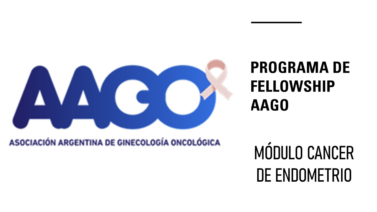 Tratamiento quirúrgico en estadios iniciales - Cancer de endometrio por dra Clara Santía