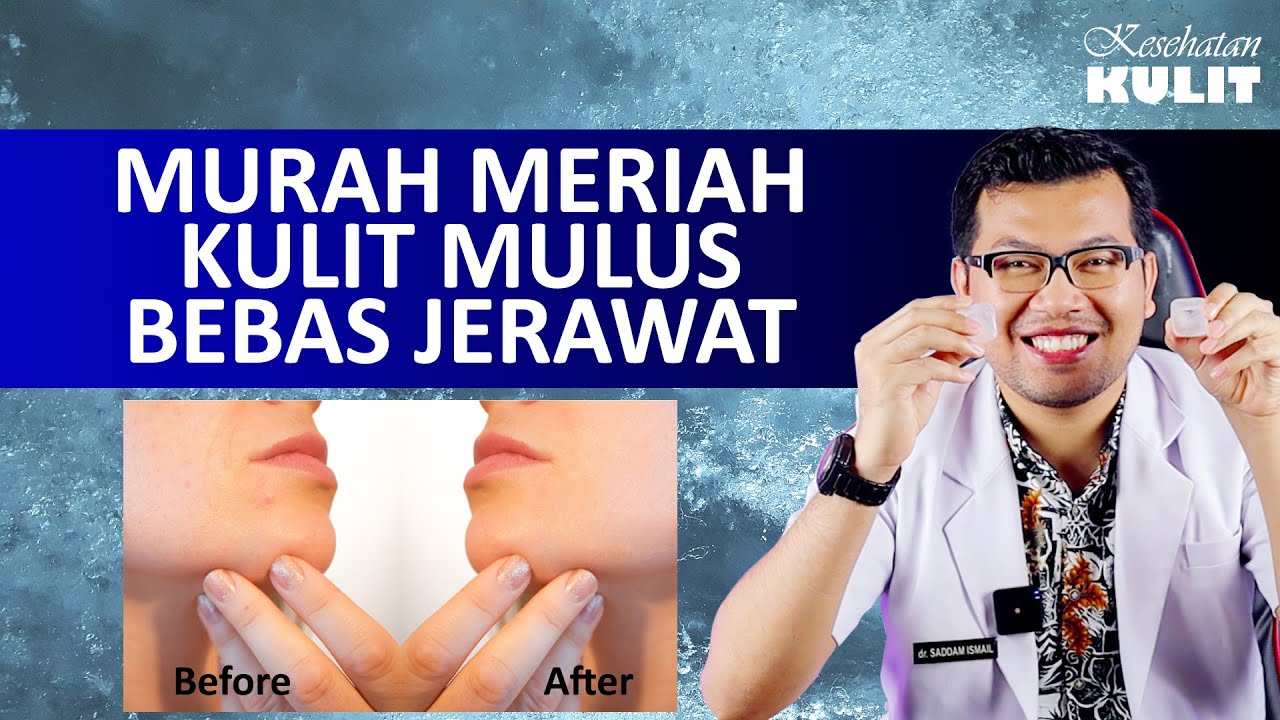 SEJUTA MANFAAT ES BATU UNTUK KULIT WAJAH MULUS BEBAS JERAWAT - DOKTER SADDAM ISMAIL