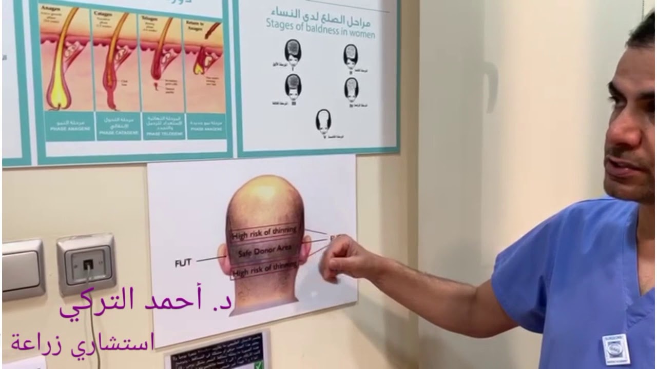مستشفى أدمة   زراعة الشعر  (لا ينضحك عليك)  د. أحمد التركي استشاري زراعة الشعر