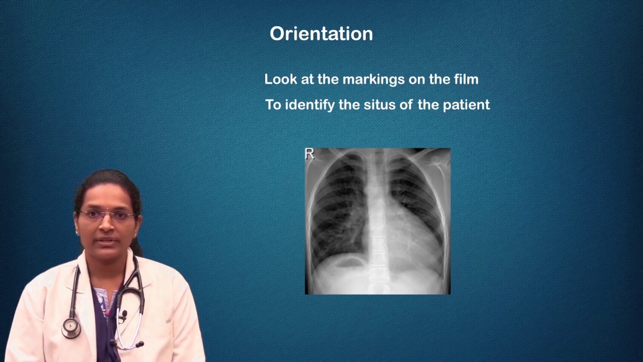 Dr. Lakshmi Shetty - X-Ray in Congenital Heart Diseases