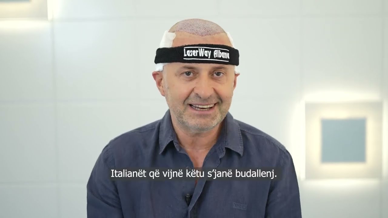 Edi Manushi zgjedh Laser Way Clinic p&euml;r transplantin e flok&euml;ve