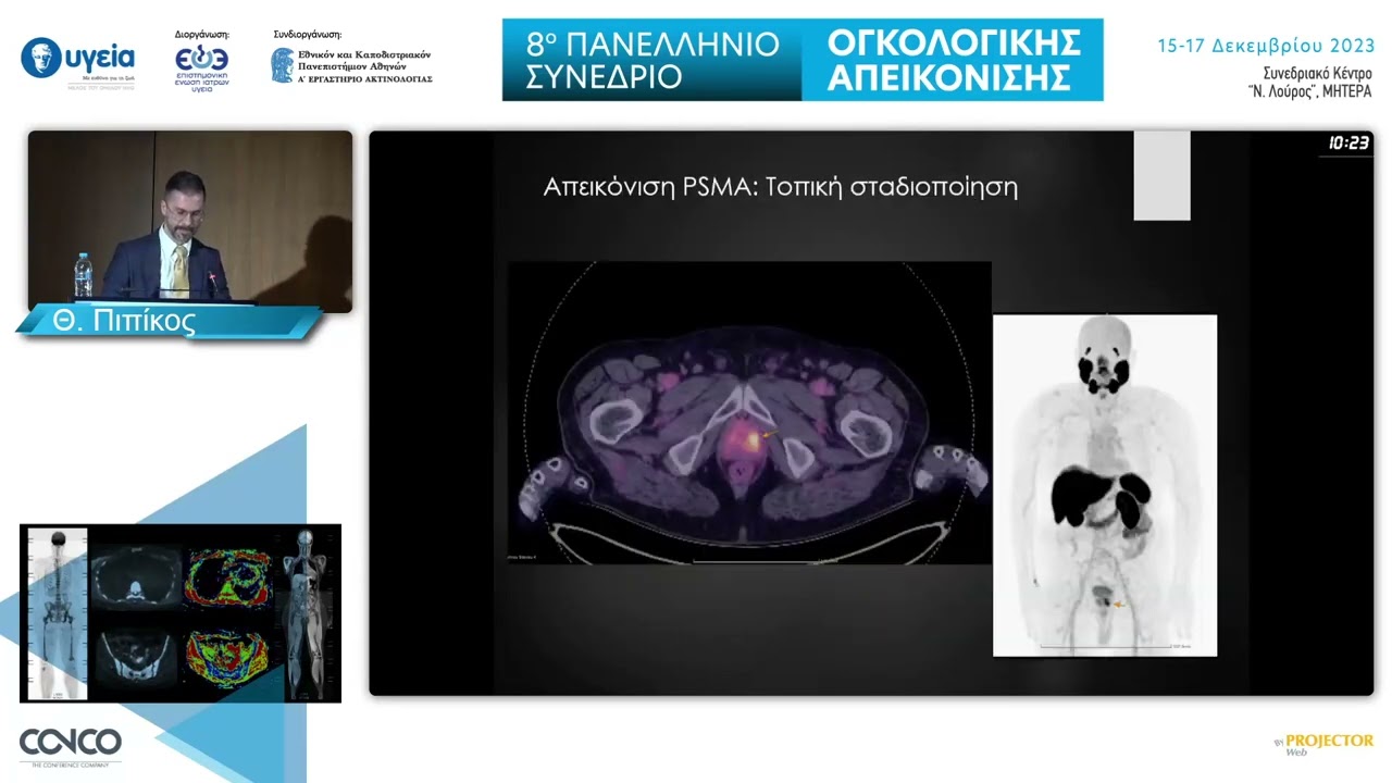 Ο ρόλος του PSMA PET/CT στη διαχείριση του καρκίνου του προστάτη