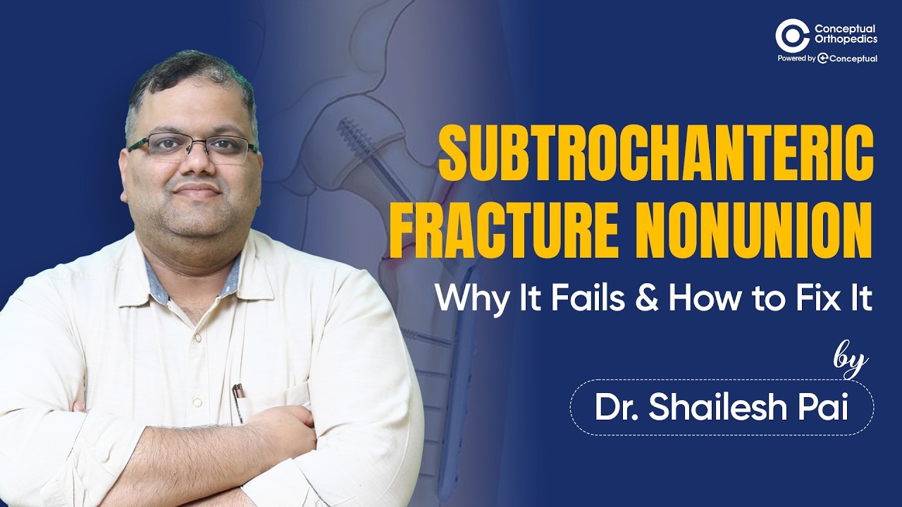 Subtrochanteric Fracture Nonunion — Why It Fails & How to Fix It | Dr. Shailesh Pai