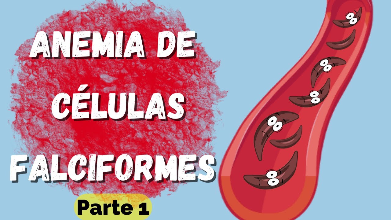 Anemia de Células Falciformes | Parte 1 | Fisiopatología