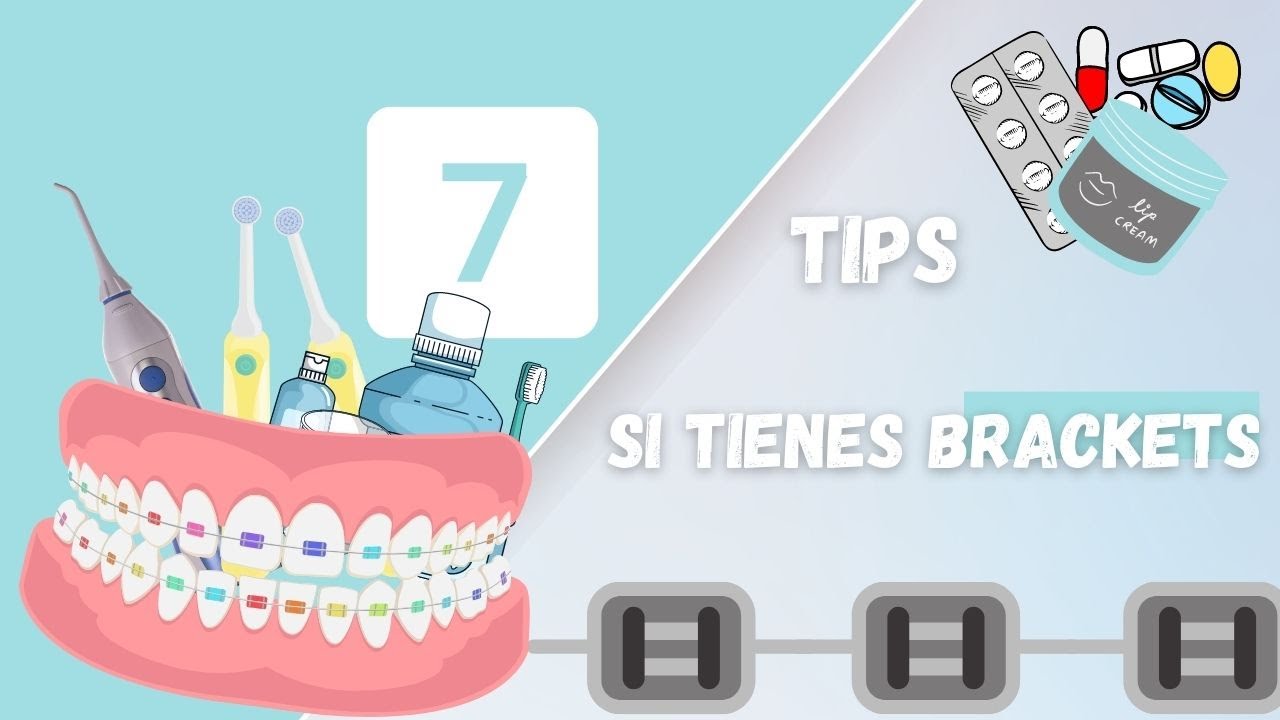 7 Tips si tienes brackets.