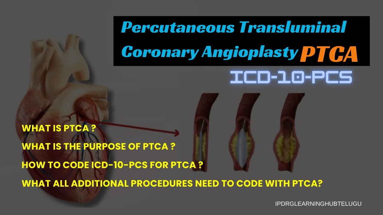 PTCA - ICD-10-PCS  Explained