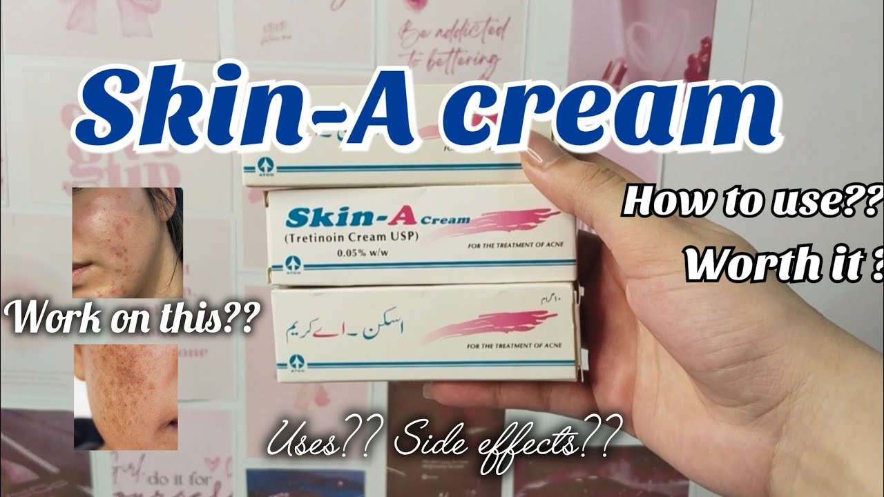 Skin A cream review | tretinoin cream | how to use skin a cream/uses , side effects