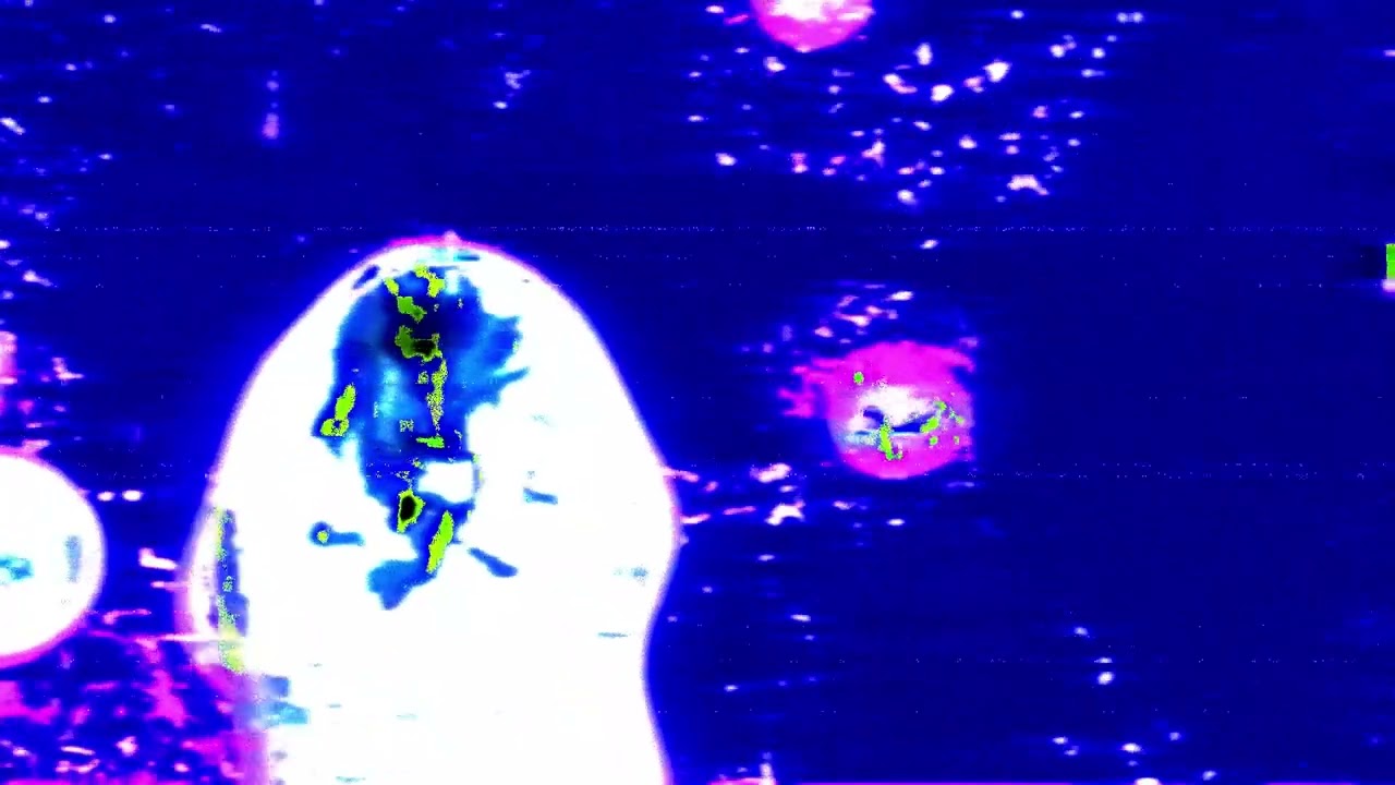 rezlaine - flea (prod. gl0wrm) MV