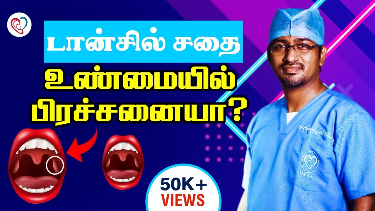 டான்சில் சதை -  உன்மையில் பிரச்சனையா ? | Tonsil Prblm in Tamil Dr. Manoj ENT Speciality Centre