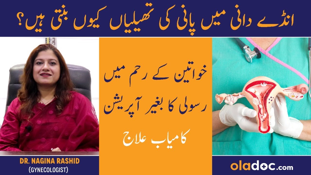 Anday Dani Mai Pani Ki Thailian Banna - Ovarian Cyst Symptoms & Treatment - Bache Dani Men Rasoli
