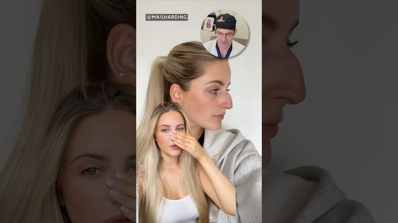 Incredible Nose Job Transformation- Surgeon Reacts