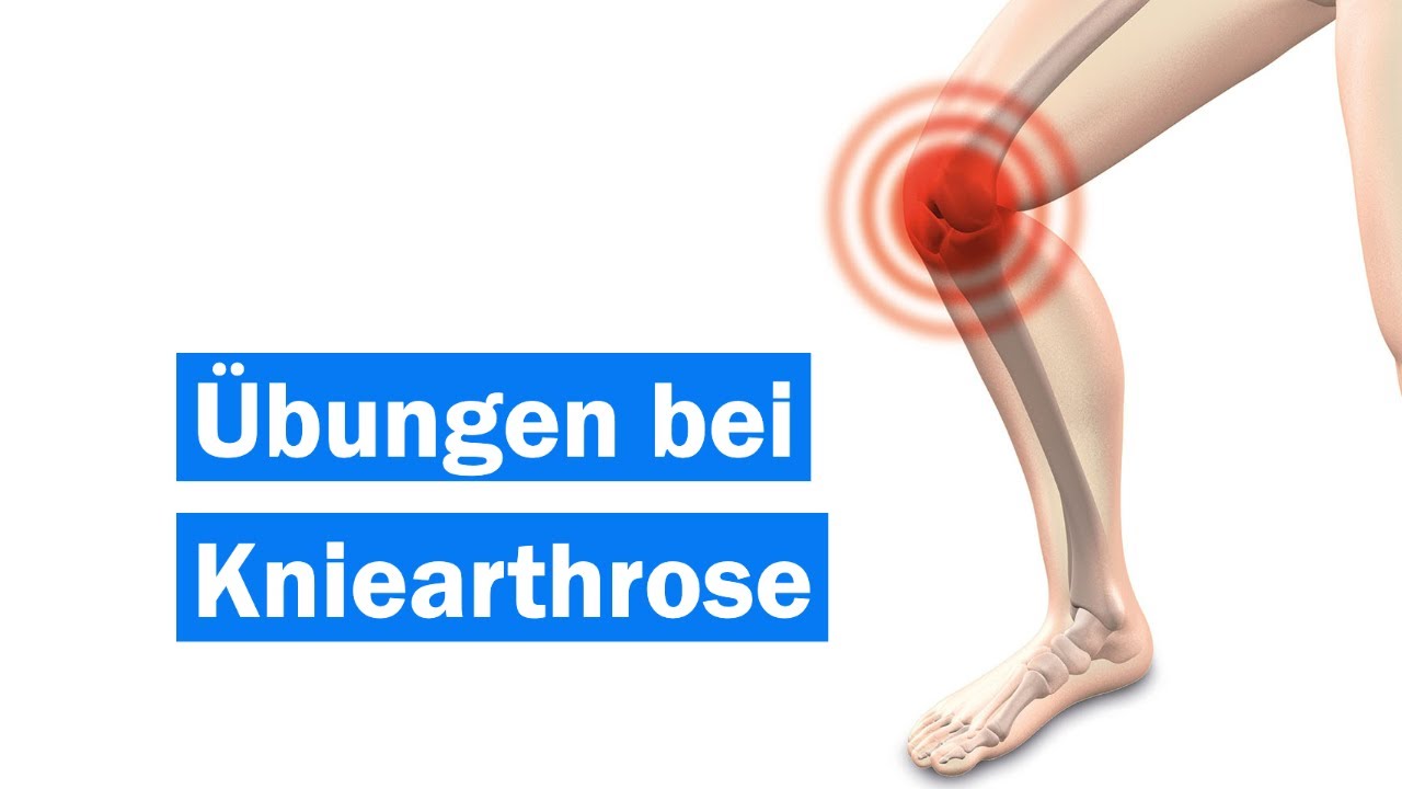 Übungen bei Kniearthrose | Krafttraining | Gonarthrose