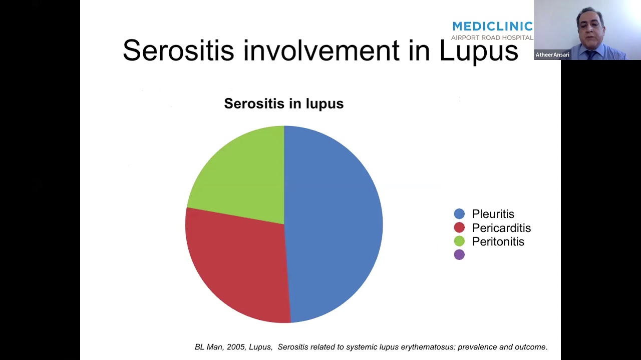 Inflammtory Serositis; clinical approach Dr. ATHEER ALANSARY