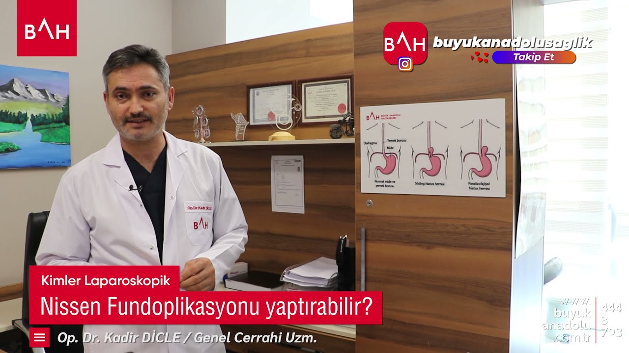 Refl&uuml; ameliyatı nasıl yapılır? (Laparoskopik Nissen fundoplikasyonu)