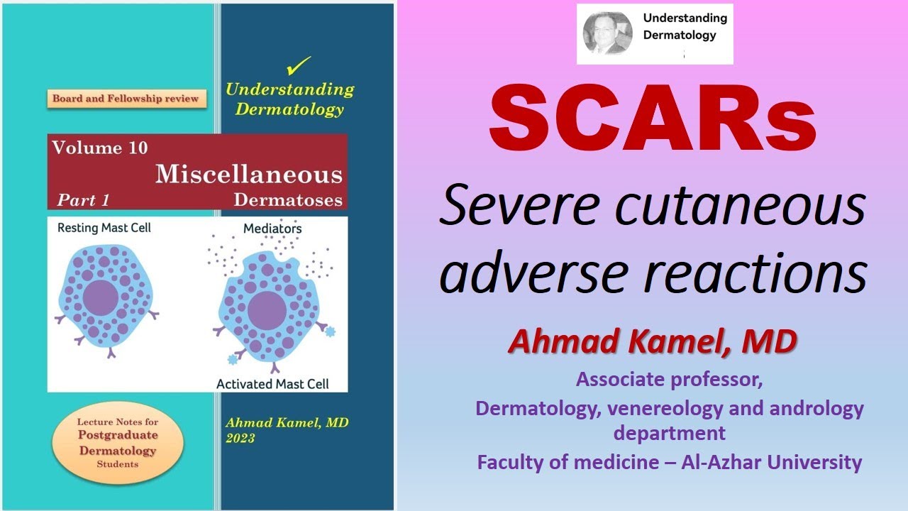 SCARS Severe cutaneous adverse reactions
