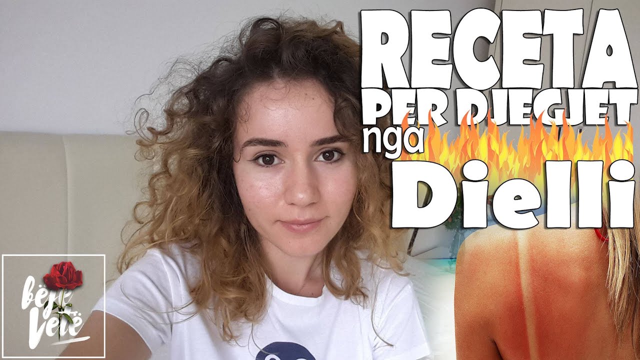 6 Receta natyrale per djegiet nga dielli. (Albanian)