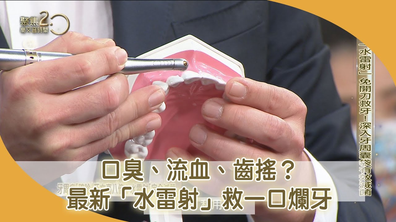 口臭、流血、齒搖？最新「水雷射」救一口爛牙【聚焦2.0】第459集