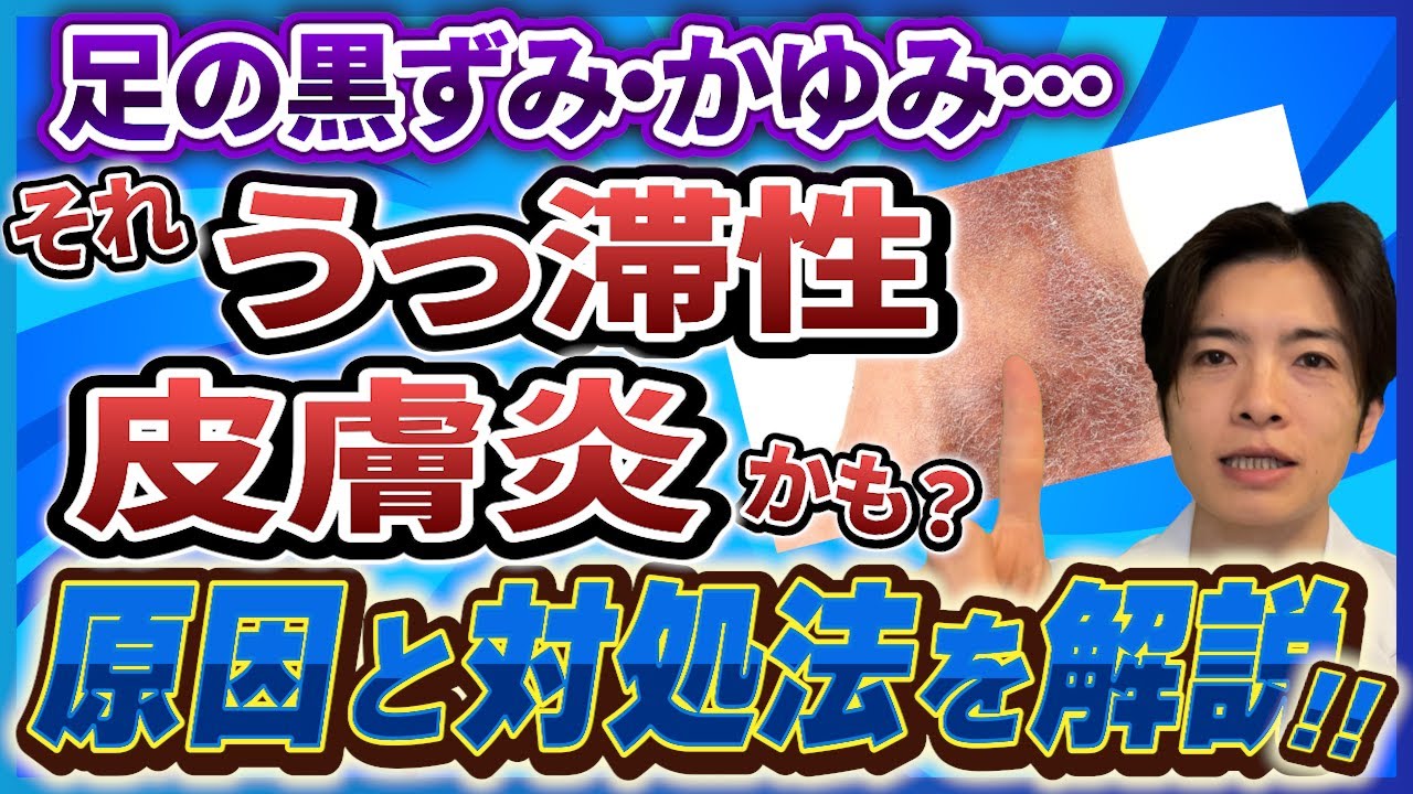 【うっ滞性皮膚炎】足の黒ずみ・かゆみ・むくみの原因とは？【下肢静脈瘤】との関係も解説