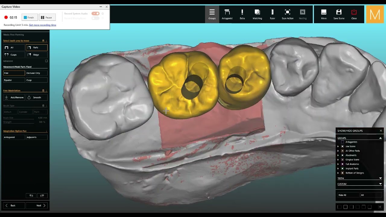 ESCANEO Y DISEÑO EN CADCAM 