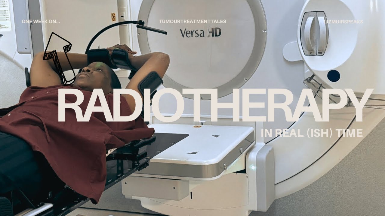 Tumour Treatment Tales - What’s radiotherapy like? (one week after finishing)